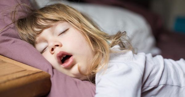 Snoring and Mouth Breathing in Children